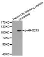 Anti-Phospho-AR-S213 antibody (STJ22019)