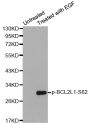 Anti-Phospho-BCL2L1-S62 antibody (STJ22039)