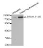 Anti-Phospho-BRCA1-S1423 antibody (STJ22043)
