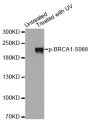 Anti-Phospho-BRCA1-S988 antibody (STJ22045)