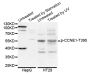 Anti-Phospho-CCNE1-T395 antibody (STJ22052)