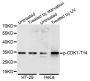 Anti-Phospho-CDK1-T14 antibody (STJ22058)
