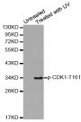 Anti-Phospho-CDK1-T161 antibody (STJ22061)