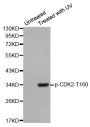 Anti-Phospho-CDK2-T160 antibody (STJ22062)