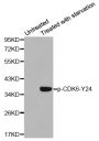 Anti-Phospho-CDK6-Y24 antibody (STJ22063)