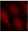 Anti-Phospho-CDK6-Y24 antibody (STJ22063)