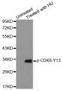 Anti-Phospho-CDK6-Y13 antibody (STJ22064)