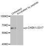 Anti-Phospho-CHEK1-S317 antibody (STJ22072)