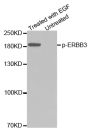 Anti-Phospho-ERBB3-Y1328 antibody (STJ22130)