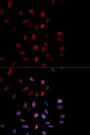 Anti-Phospho-FOS-T232 antibody (STJ22143)