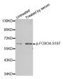 Anti-Phospho-FOXO4-S197 antibody (STJ22147)