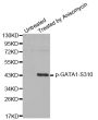 Anti-Phospho-GATA1-S310 antibody (STJ22152)