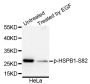 Anti-Phospho-HSPB1-S82 antibody (STJ22179)