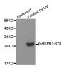 Anti-Phospho-HSPB1-S78 antibody (STJ22181)