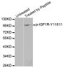 Anti-Phospho-IGF1R-Y1161 antibody (STJ22186)