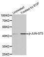 Anti-Phospho-JUN-S73 antibody (STJ22209)