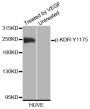 Anti-Phospho-KDR-Y1175 antibody (STJ22219)