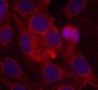 Anti-Phospho-KDR-Y1175 antibody (STJ22219)
