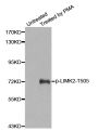 Anti-Phospho-LIMK2-T505 antibody (STJ22229)