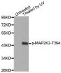 Anti-Phospho-MAP2K2-T394 antibody (STJ22237)