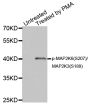 Anti-Phospho-MAP2K3/MAP2K6-S207/S189 antibody (STJ22246)