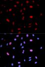 Anti-Phospho-MAP2K3/MAP2K6-S207/S189 antibody (STJ22246)
