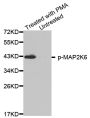 Anti-Phospho-MAP2K6-S207 antibody (STJ22247)