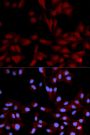Anti-Phospho-MAPK14-Y182 antibody (STJ22257)