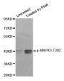 Anti-Phospho-MAPK3-T202 antibody (STJ22261)