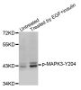 Anti-Phospho-MAPK3-Y204 antibody (STJ22262)