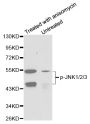 Anti-Phospho-MAPK8/MAPK9/MAPK10-T183/Y185 & T183/Y185 & T221/Y223 antibody (STJ22264)
