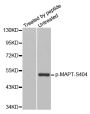 Anti-Phospho-MAPT-S404 antibody (STJ22272)