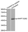 Anti-Phospho-MAPT-S262 antibody (STJ22274)