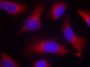 Anti-Phospho-MAPT-S262 antibody (STJ22274)