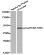 Anti-Phospho-MARCKS-S158 antibody (STJ22279)
