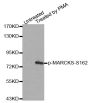 Anti-Phospho-MARCKS-S162 antibody (STJ22280)