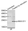 Anti-Phospho-MAX-S11 antibody (STJ22282)