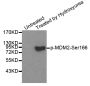 Anti-Phospho-MDM2-S166 antibody (STJ22283)