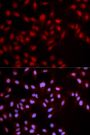 Anti-Phospho-MET-Y1349 antibody (STJ22291)