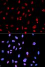 Anti-Phospho-MET-Y1234 antibody (STJ22292)