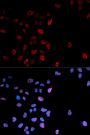 Anti-Phospho-MYC-S62 antibody (STJ22299)