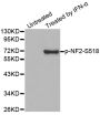 Anti-Phospho-NF2-S518 antibody (STJ22307)