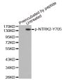 Anti-Phospho-NTRK2-Y705 antibody (STJ22323)