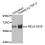 Anti-Phospho-RELA-S529 antibody (STJ22379)