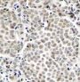 Anti-Phospho-RELA-S529 antibody (STJ22379)