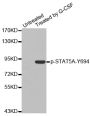 Anti-Phospho-STAT5A-Y694 antibody (STJ22417)