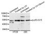 Anti-Phospho-TP53-S15 antibody (STJ22433)