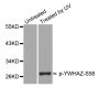 Anti-Phospho-YWHAZ-S58 antibody (STJ22447)