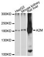 Anti-A2M antibody (1155-1474) (STJ22453)
