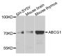Anti-ABCG1 antibody (6-120) (STJ22465)